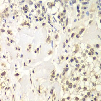 USP7 / HAUSP Antibody