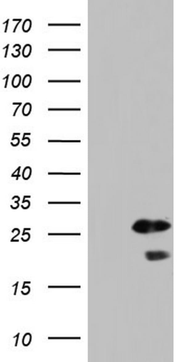 Monoclonal Mouse anti-Human SPA17 / Sperm Protein 17 Antibody (clone OTI1H6, WB)