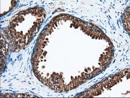 ACAT2 Antibody (clone OTI1B7)