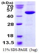 Human METAP1 Protein (Recombinant His)