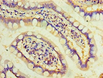 DAND5 Antibody (aa23-189)