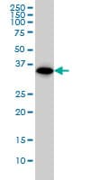 IHC-plus™ THOC6 Antibody (clone 1F6)