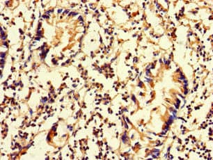 Polyclonal Rabbit anti-Human DNAAF3 Antibody (IHC, IF)