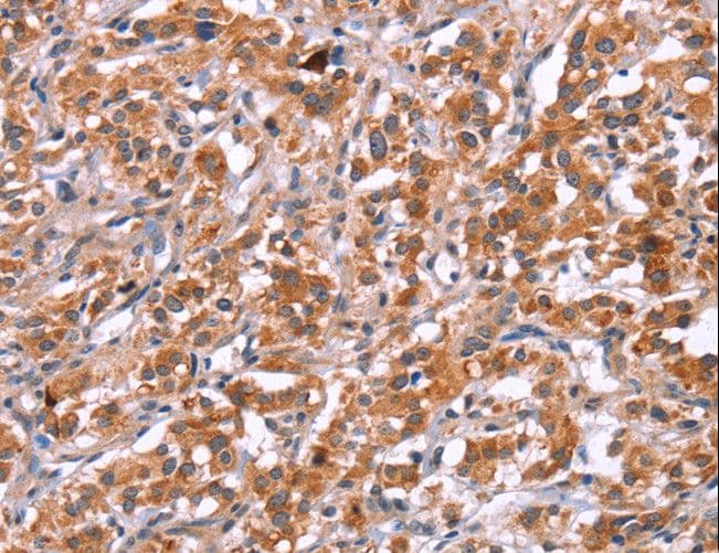 Polyclonal Rabbit anti-Human ICAM5 / ICAM-5 Antibody (IHC, WB)