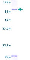 Human PPP2R1A Protein (Recombinant GST)