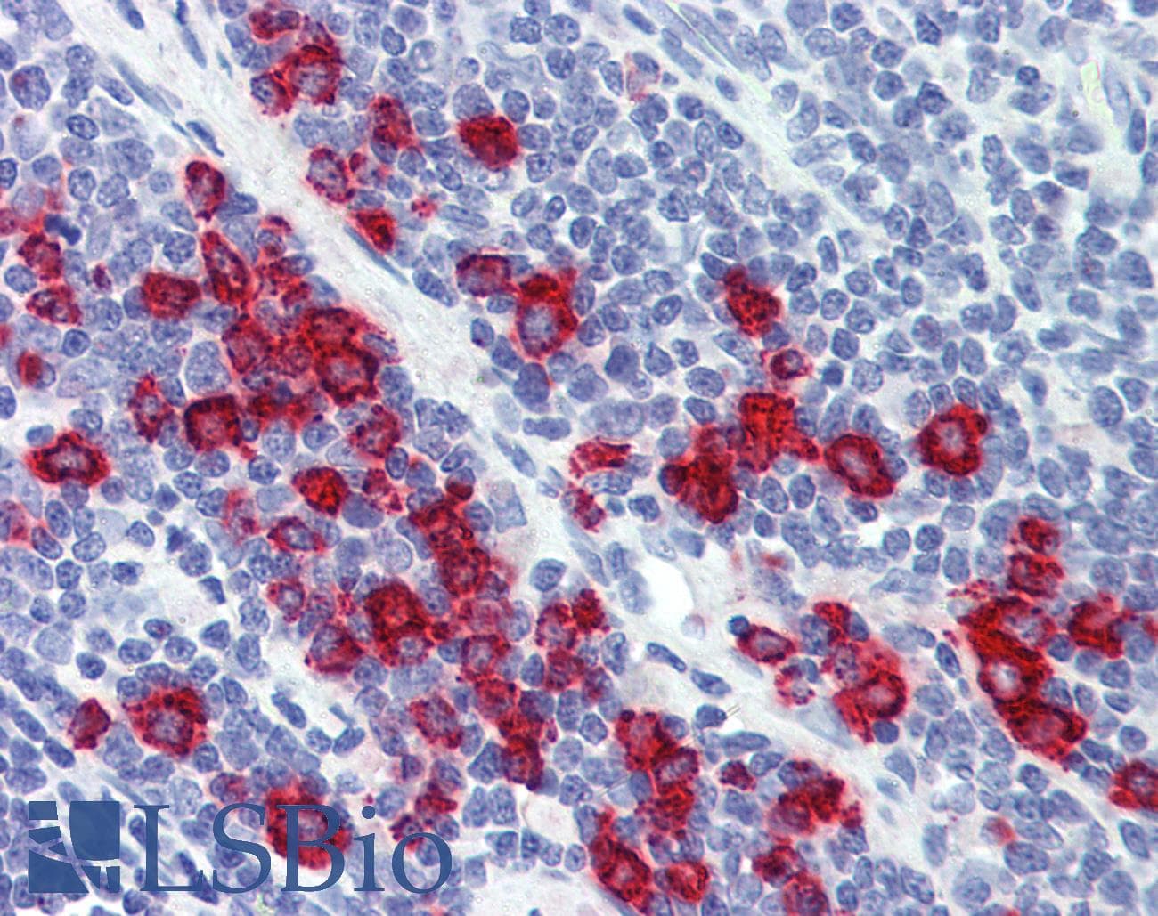 PathPlus™ Monoclonal Mouse anti-Human MPO / Myeloperoxidase Antibody (clone 9B12G7, IHC, WB)