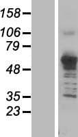 ASNS Protein (Over-Expression Lysate Myc-DDK (Flag))