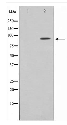 NR3C1/Glucocorticoid Receptor Antibody