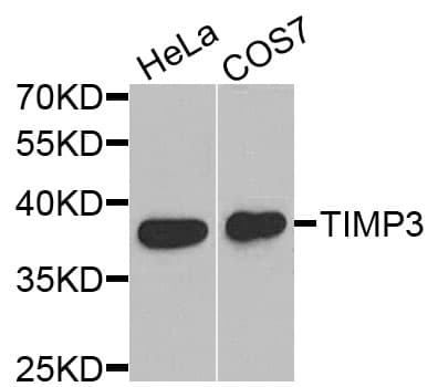 Polyclonal Rabbit anti-Human TIMP3 Antibody (IHC, IF, WB)
