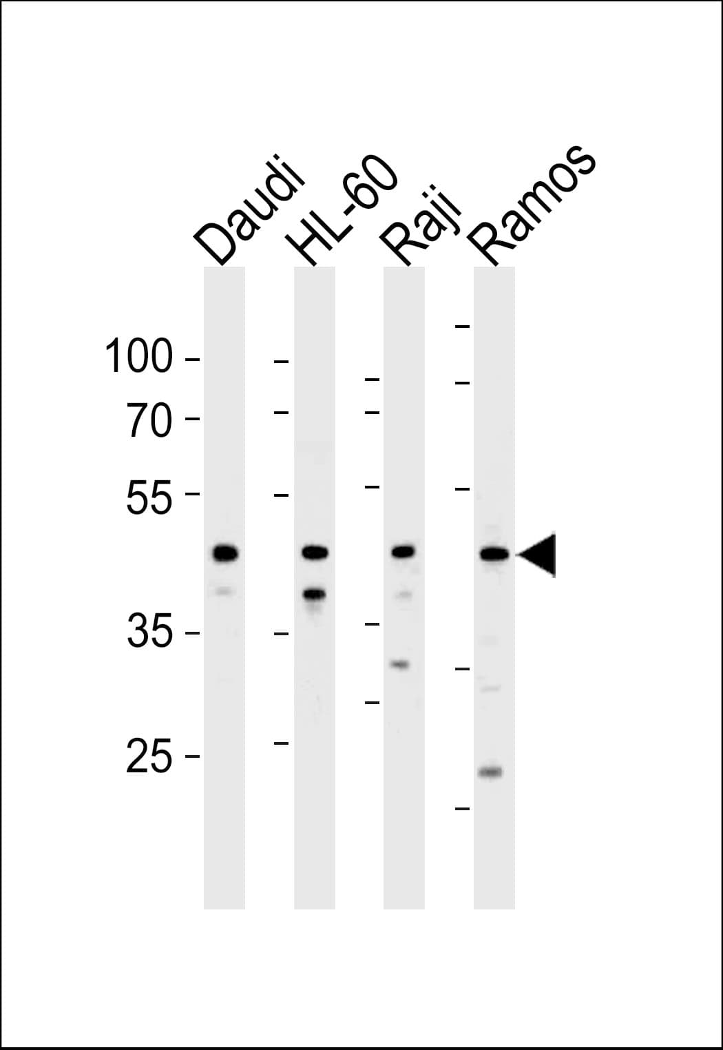 LILRA3 / CD85e Antibody (aa350-378)