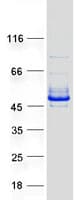 Human RNF113B Protein (Recombinant Myc-DDK (Flag))