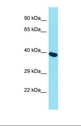 MCM7 Antibody (aa32-81)