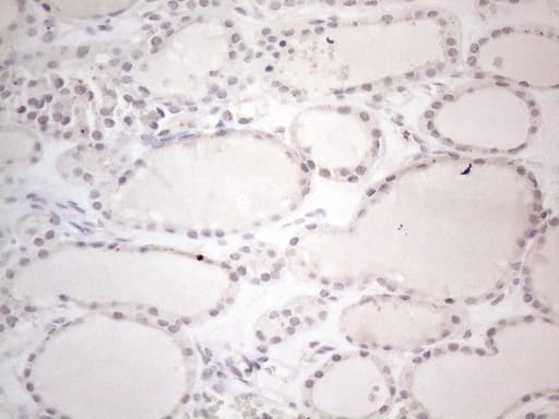 CTBP2 Antibody (aa233-336, clone OTI4D4)
