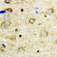 NFU1 Antibody