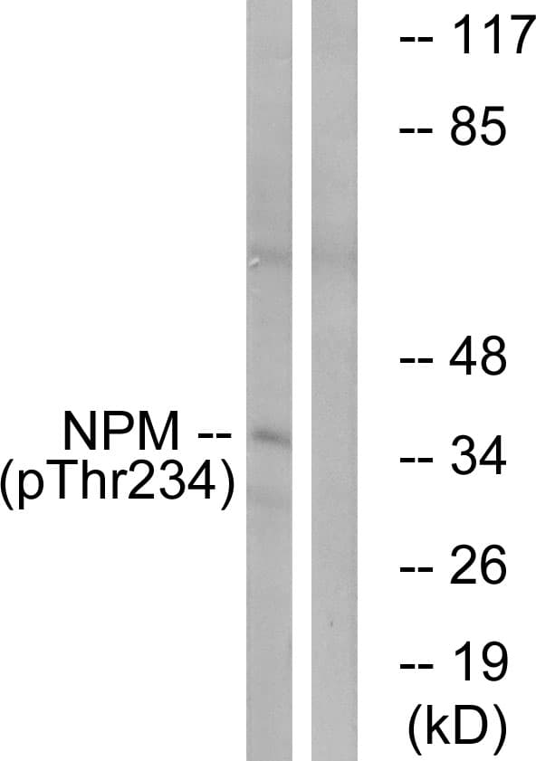 NPM1 / NPM / Nucleophosmin Antibody (phospho-Thr234)