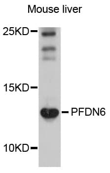 Polyclonal Rabbit anti-Human PFDN6 / HKE2 Antibody (WB)