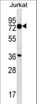 PLS1 / Fimbrin Antibody (aa550-579)