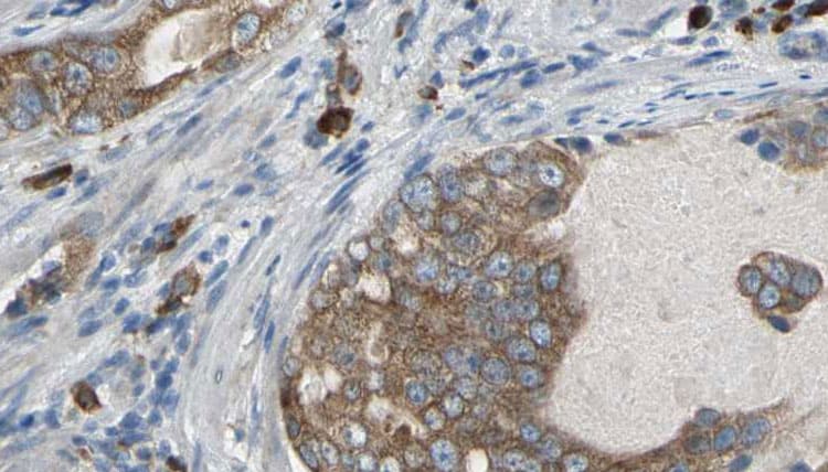 PDE1B Antibody
