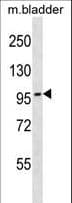 TOP3B Antibody (aa826-854)