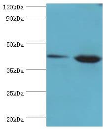 IHC-plus™ ERGIC2 Antibody (aa55-310)