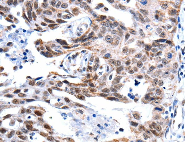 GSK3A / GSK3 Alpha Antibody