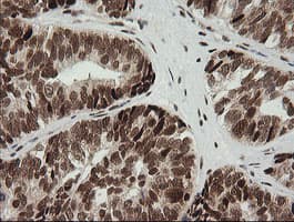 ZSCAN18 / ZNF447 Antibody (clone OTI1F10)