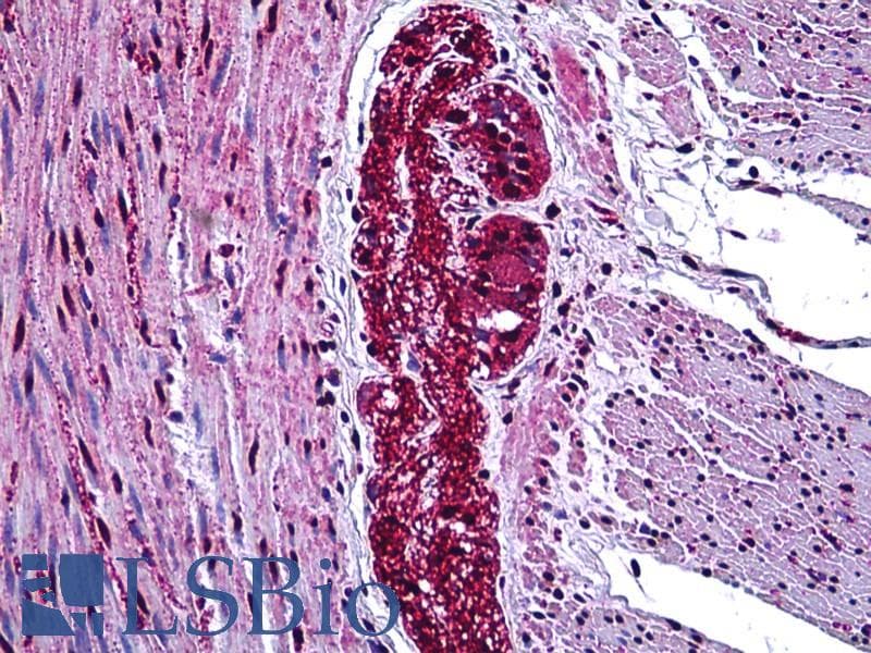 IHC-plus™ Polyclonal Rabbit anti-Human MAP3K7 / TAK1 Antibody (aa161-210, IHC, WB)