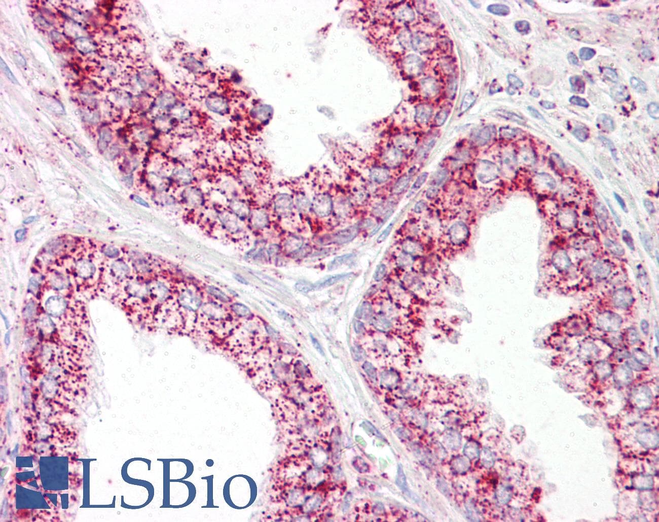 IHC-plus™ HSPE1 / HSP10 / Chaperonin 10 Antibody (aa51-100)