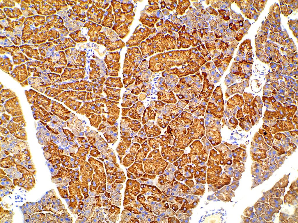 PIK3R1 / p85 Alpha Antibody (phospho-Tyr607)