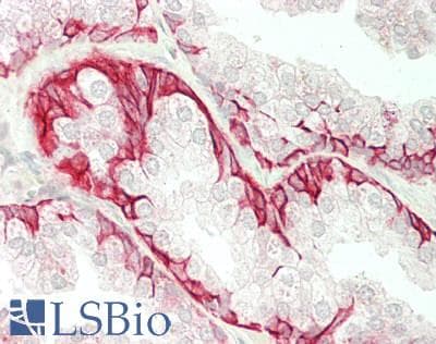 IHC-plus™ Polyclonal Rabbit anti-Human FZD6 / Frizzled 6 Antibody (aa108-157, IHC, WB)