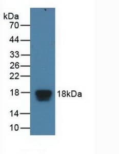 EIF4EBP1 / 4EBP1 Antibody (aa2-118)