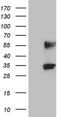 PROCR / EPCR Antibody (aa1-210, clone OTI6B10)
