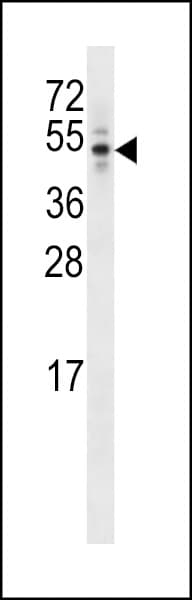 IHC-plus™ CEP44 / KIAA1712 Antibody (aa278-307)
