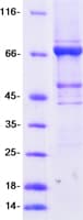 Human TRMT2A Protein (Recombinant Myc-DDK (Flag))