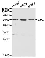 Polyclonal Rabbit anti-Human LIPC / Hepatic Lipase Antibody (IHC, WB)