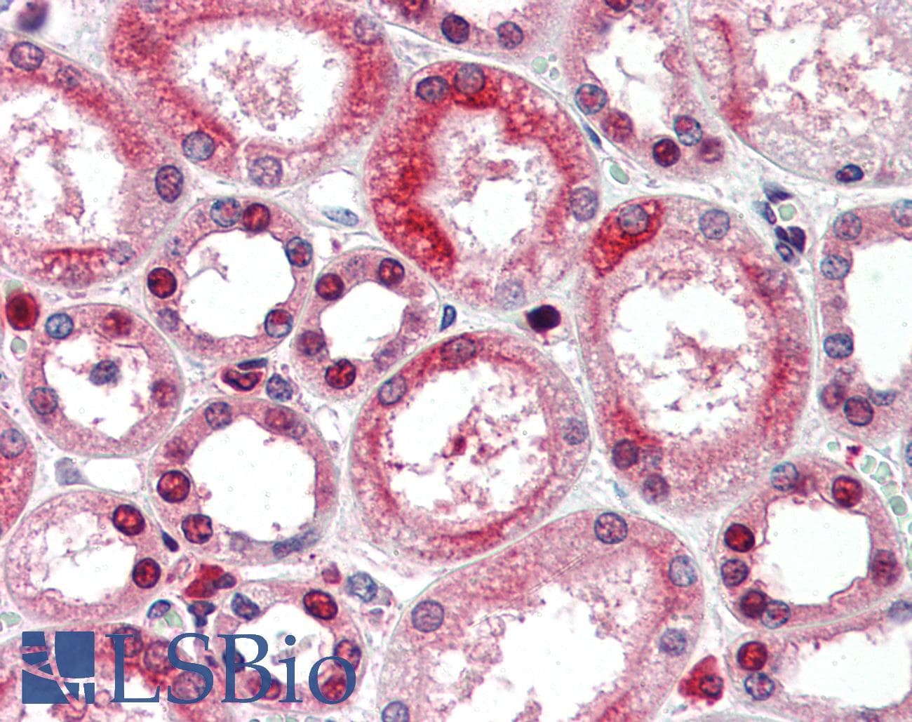 IHC-plus™ PHAP1 / ANP32A Antibody