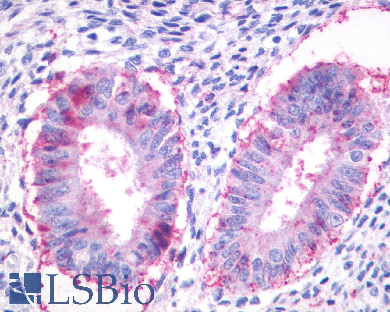 PathPlus™ Polyclonal Rabbit anti-Human GPR27 Antibody (N-Terminus, IHC)
