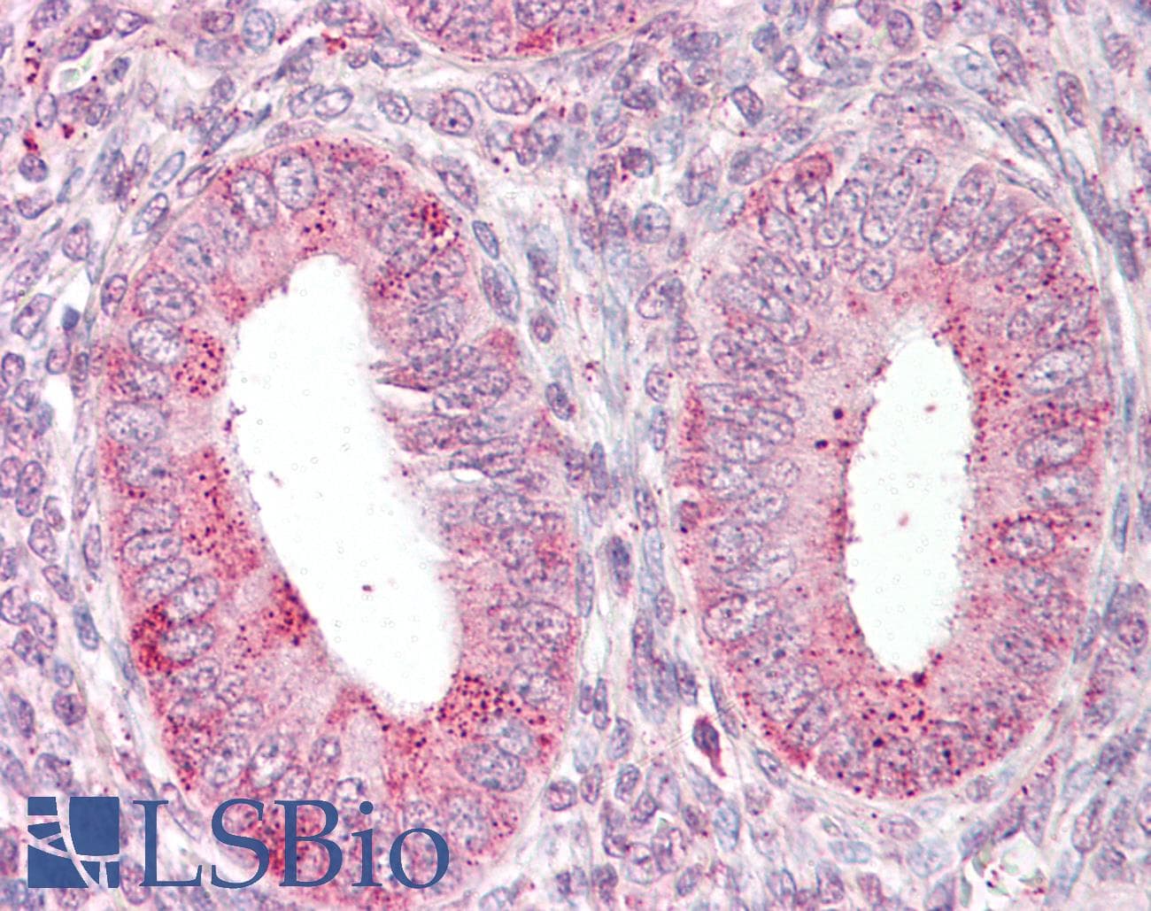 IHC-plus™ Polyclonal Rabbit anti-Human TRXR1 / TXNRD1 Antibody (IHC, WB)