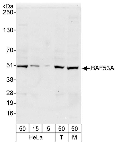 IHC-plus™ Polyclonal Rabbit anti-Human BAF53 / ACTL6A Antibody (aa25-75, IHC, WB)