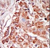 Polyclonal Rabbit anti-Human EIF2AK2 / PKR Antibody (aa11-42, IHC, WB)