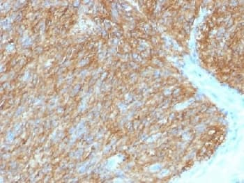Monoclonal Mouse anti-Human ANO1 / DOG1 / TMEM16A Antibody (clone DG1/1486, Azide-free,BSA-free, IHC)