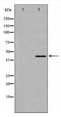 DMTN / Dematin Antibody