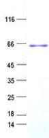 Human ZBTB34 Protein (Recombinant His, N-Terminal)