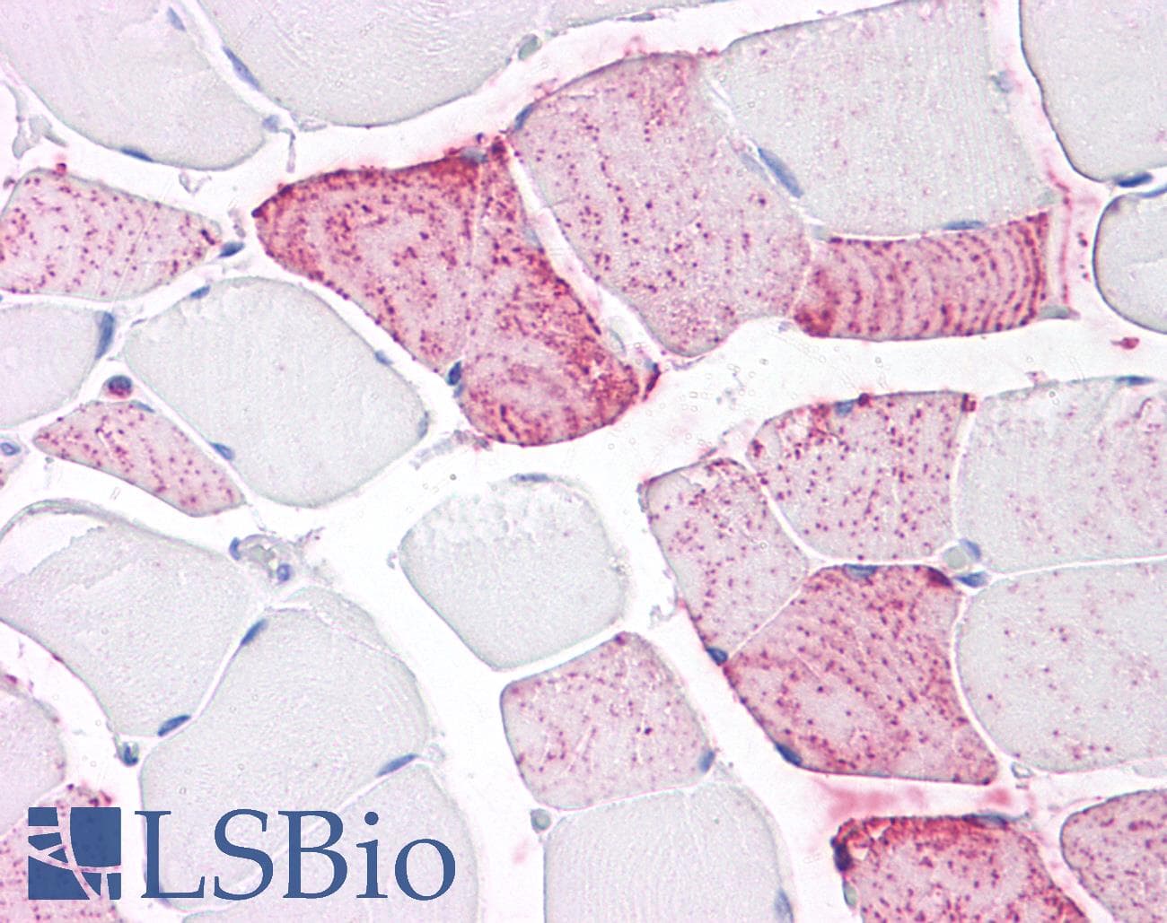 PathPlus™ PTPRA / RPTP-Alpha Antibody (Extracellular Domain)