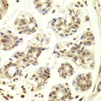 PRPF3 Antibody
