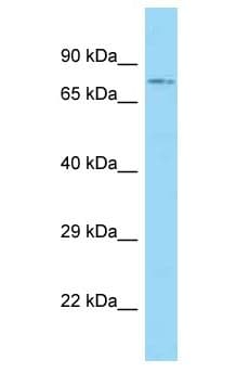 ACSBG1 / hsBG Antibody (aa15-64)