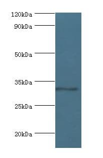 Polyclonal Rabbit anti-Human CRD / CRX Antibody (aa120-285, IHC, WB)