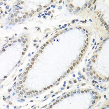 ELAVL1 / HUR Antibody