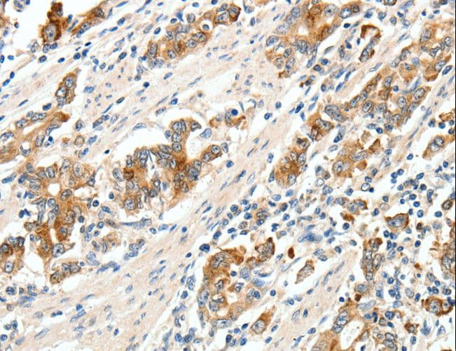 SCN9A / Nav1.7 Antibody