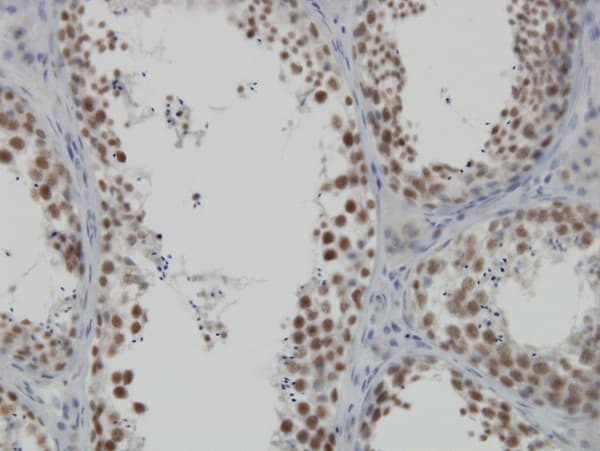 INTS6 Antibody (clone 3D9)